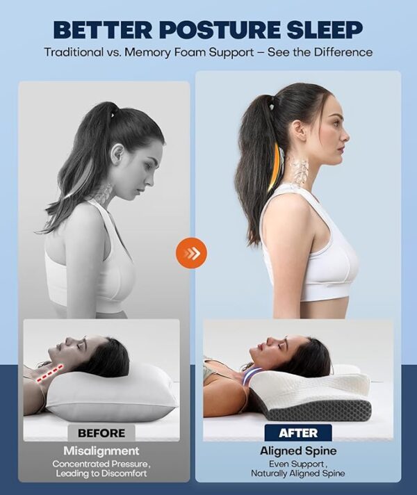 Sleep Doctor Approved Cervical Neck Pillow for Sleeping (76% off limited time deal) - Image 4