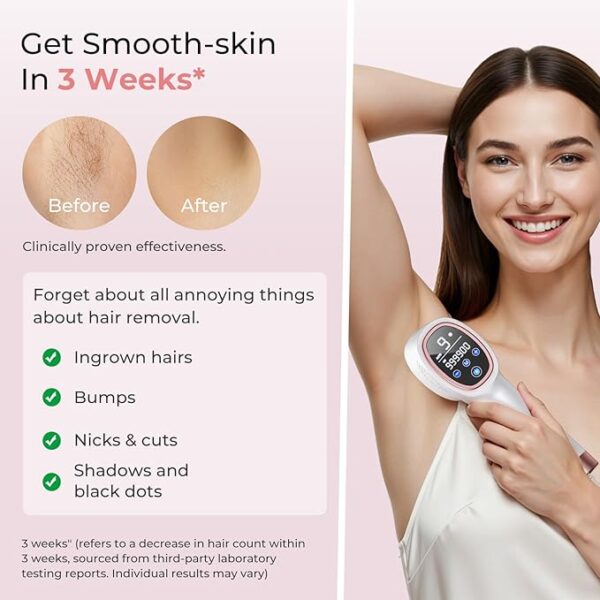 Laser Hair Removal for Women & Men - Image 2